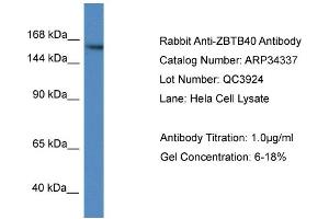 WB Suggested Anti-ZBTB40 Antibody   Titration: 1. (ZBTB40 anticorps  (N-Term))