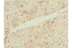 Immunohistochemistry of paraffin-embedded human heart tissue using ABIN7171700 at dilution of 1:100 (TCAP anticorps  (AA 1-167))