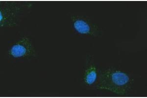 IF analysis of Citrin/SLC25A13 using anti-Citrin/SLC25A13 antibody (ABIN7599512). (slc25a13 anticorps  (AA 1-643))