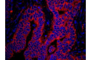 Immunofluorescence (IF) image for anti-RpL7a/SURF3 (C-Term) antibody (ABIN7449015) (RpL7a/SURF3 (C-Term) anticorps)