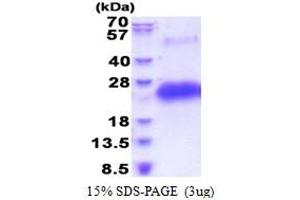 SDS-PAGE (SDS) image for CD40 (CD40) (AA 21-193) protein (His tag) (ABIN5853618)