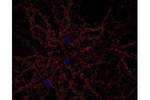Indirect immunostaining of PFA fixed rat hippocampus neurons (dilution 1 : 500; red). (CACNA1B anticorps  (alpha-1E subunit))