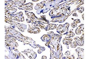IHC analysis of VEGF Receptor 3 using anti-VEGF Receptor 3 antibody .