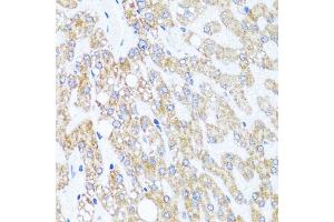 Immunohistochemistry of paraffin-embedded human liver injury using CHD1 antibody (ABIN5975217) at dilution of 1/100 (40x lens). (CHD1 anticorps)