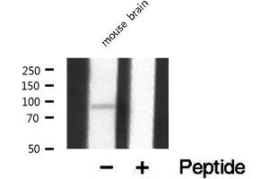 Western blot analysis of extracts from mouse Brian, using MEKKK 1 antibody. (MAP4K1 anticorps  (Internal Region))