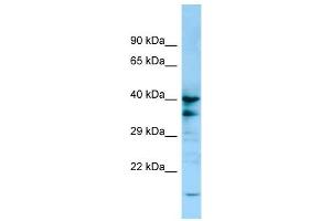 WB Suggested Anti-P2RY13 Antibody Titration: 1. (Purinergic Receptor P2Y, G-Protein Coupled, 13 (P2RY13) (C-Term) anticorps)