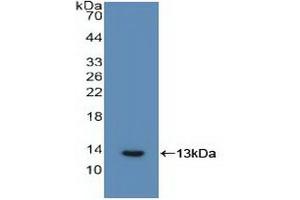 Western blot analysis of recombinant Human IL6R. (IL-6 Receptor anticorps  (AA 216-356))