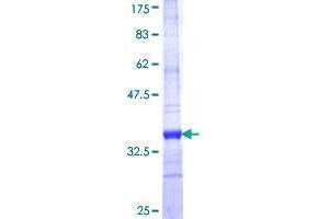 Image no. 1 for Solute Carrier Family 2 (Facilitated Glucose Transporter), Member 9 (SLC2A9) (AA 224-287) protein (GST tag) (ABIN1320366)