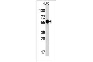 Western blot analysis of anti-IL1R in HL60 cell line lysates (35ug/lane). (IL1RL2 anticorps  (C-Term))