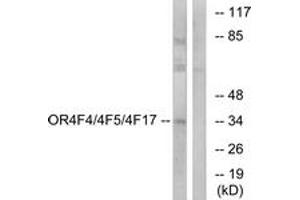 Western blot analysis of extracts from MCF-7 cells, using OR4F4/4F5/4F17 Antibody. (OR4F4/4F5/4F17 anticorps  (AA 51-100))