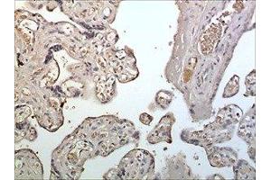 Immunohistochemistry (IHC) image for anti-Leukocyte Immunoglobulin-Like Receptor, Subfamily A (With TM Domain), Member 6 (LILRA6) (AA 24-443) antibody (ABIN1983300)