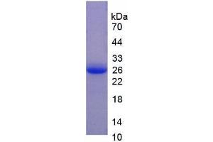 SDS-PAGE analysis of Pig Coagulation Factor V Protein. (Coagulation Factor V Protein (F5))