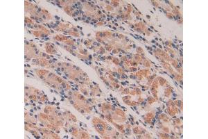 Used in DAB staining on fromalin fixed paraffin- embedded stomach tissue