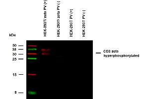 Anti-Hu CD3 zeta (pY72) Purified (clone EM-26) specificity verification by WB. (CD247 anticorps  (Tyr72))