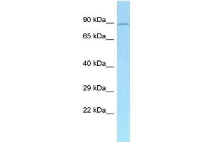 WB Suggested Anti-Add1 Antibody Titration: 1. (alpha Adducin anticorps  (N-Term))