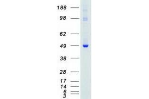 Validation with Western Blot