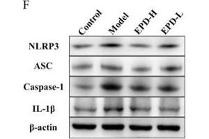 EPD inhibited the IMQ-activated nucleotide-binding oligomerization domain (Nod)-like receptor family pyrin domain-containing 3 (NLRP3) inflammasome signaling pathway.