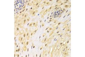 Immunohistochemistry (IHC) image for anti-Apoptosis-Inducing Factor, Mitochondrion-Associated, 1 (AIFM1) (AA 334-613) antibody (ABIN3023385)