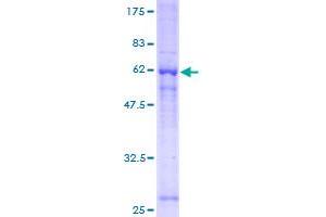 Image no. 1 for Guanine Nucleotide Binding Protein (G Protein), beta Polypeptide 1 (GNB1) (AA 1-340) protein (GST tag) (ABIN1355355)