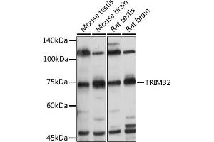 Western blot analysis of extracts of various cell lines, using TRIM32 antibody (ABIN6132735, ABIN6149520, ABIN6149521 and ABIN6222878) at 1:500 dilution. (TRIM32 anticorps  (AA 1-280))