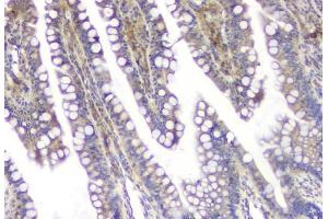 IHC analysis of SQSTM1 using anti-SQSTM1 antibody (ABIN3043937). (SQSTM1 anticorps  (N-Term))