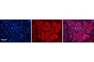Rabbit Anti-NFATC1 Antibody    Formalin Fixed Paraffin Embedded Tissue: Human Adult heart  Observed Staining: Cytoplasmic Primary Antibody Concentration: 1:600 Secondary Antibody: Donkey anti-Rabbit-Cy2/3 Secondary Antibody Concentration: 1:200 Magnification: 20X Exposure Time: 0. (NFATC1 anticorps  (Middle Region))