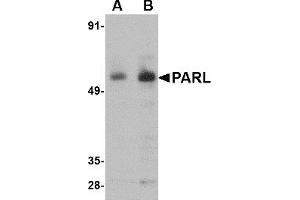Western Blotting (WB) image for anti-Presenilin Associated, Rhomboid-Like (PARL) (N-Term) antibody (ABIN1031504) (PARL anticorps  (N-Term))