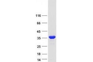 Validation with Western Blot