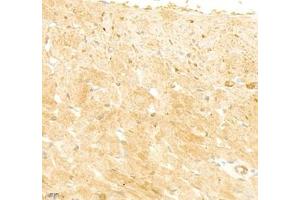 Immunohistochemistry of paraffin embedded rat heart using collagen alpha-1 (V) (ABIN7073547) at dilution of 1: 1800 (400x lens) (Collagen Type V anticorps)