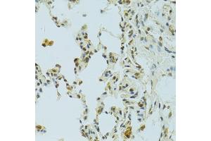 Immunohistochemistry of paraffin-embedded rat lung using RSRC1 antibody (ABIN5974341) at dilution of 1/100 (40x lens). (RSRC1 anticorps)