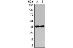Western blot analysis of KIM1 expression in Hela (A), HEK293T (B) whole cell lysates. (HAVCR1 anticorps  (N-Term))