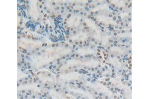 Used in DAB staining on fromalin fixed paraffin- embedded Kidney tissue