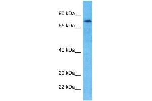 Host:  Rabbit  Target Name:  GPAT2  Sample Type:  Hela Whole Cell lysates  Antibody Dilution:  1.