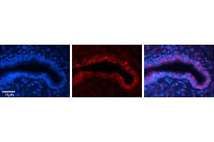 Rabbit Anti-RPN2 Antibody     Formalin Fixed Paraffin Embedded Tissue: Human Bronchial Epithelial Tissue  Observed Staining: Cytoplasmic  Primary Antibody Concentration: 1:100  Other Working Concentrations: 1/600  Secondary Antibody: Donkey anti-Rabbit-Cy3  Secondary Antibody Concentration: 1:200  Magnification: 20X  Exposure Time: 0.