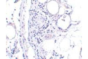 Immunohistochemistry of FABP7 in human breast tissue with FABP7 polyclonal antibody  at 5 ug/mL .