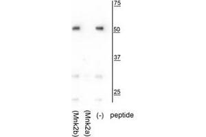 Western blot of HeLa lysate showing specific immunolabeling of the ~52 kDa Mnk2a isoform in the third lane (-).