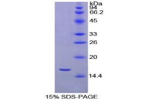 SDS-PAGE analysis of Chicken Transthyretin Protein. (TTR Protéine)