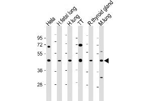 All lanes : Anti-NKX2-1 Antibody (N-term) at 1:2000 dilution Lane 1: Hela whole cell lysate Lane 2: human fetal lung lysate Lane 3: human lung lysate Lane 4: TT whole cell lysate Lane 5: rat thyroid gland lysate Lane 6: mouse lung lysate Lysates/proteins at 20 μg per lane.