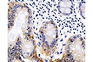 Immunohistochemistry analysis of paraffin-embedded Human colon using Catenin beta Monoclonal Antibody at dilution of 1:200.