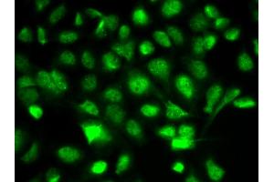 Immunofluorescence analysis of A549 cells using BIRC2 antibody (ABIN6292780). (BIRC2 anticorps)