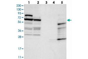 Western blot analysis of Lane 1: RT-4, Lane 2: U-251 MG, Lane 3: Human Plasma, Lane 4: Liver, Lane 5: Tonsil with NOP5/NOP58 polyclonal antibody  at 1:250-1:500 dilution. (NOP58 anticorps)