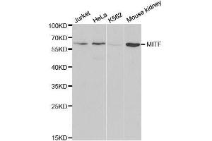 Western blot analysis of extracts of various cell lines, using MITF antibody. (MITF anticorps  (AA 1-280))