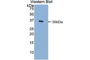 Detection of Recombinant CYP21A2, Human using Polyclonal Antibody to Cytochrome P450 Family 21 Subfamily A Member 2 (CYP21A2)