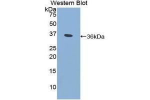 Detection of Recombinant CYP21A2, Human using Polyclonal Antibody to Cytochrome P450 Family 21 Subfamily A Member 2 (CYP21A2) (CYP21A2 anticorps  (AA 106-389))