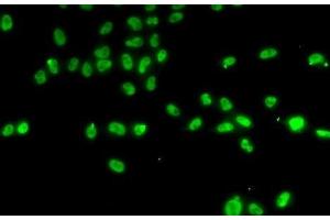 Immunofluorescence analysis of A-549 cells using ZNF148 Polyclonal Antibody (ZNF148 anticorps)