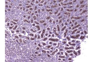 IHC analysis of CCL8 using anti-CCL8 antibody (ABIN6719605). (CCL8 anticorps  (AA 24-97))