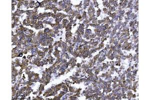 IHC analysis of ERLIN2 using anti-ERLIN2 antibody (ABIN7602582). (ERLIN2 anticorps  (AA 87-339))