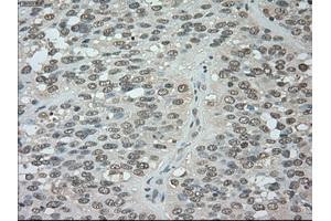 Image no. 5 for anti-Budding Uninhibited By Benzimidazoles 1 Homolog beta (Yeast) (BUB1B) antibody (ABIN1497000) (BUB1B anticorps)