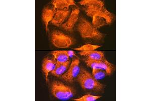 Immunofluorescence analysis of U-2 OS cells using PHKG2 Rabbit pAb  at dilution of 1:100 (40x lens). (PHKG2 anticorps  (AA 237-406))