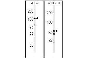 (LEFT) Western blot analysis of TAF2 Antibody (C-Term) in MCF-7 cell line lysates (35µg/lane). (TAF2 anticorps  (C-Term))